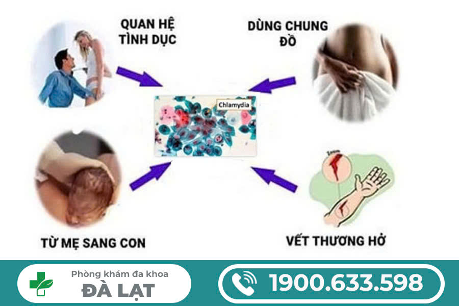 Hình ảnh minh họa